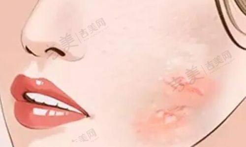河源华美医疗整形美容医院价格表