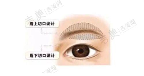 合肥华美整形医院怎么样,口碑评价如何?