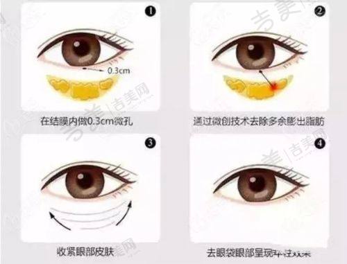 丽水华美整形门诊部怎么样,口碑评价如何?