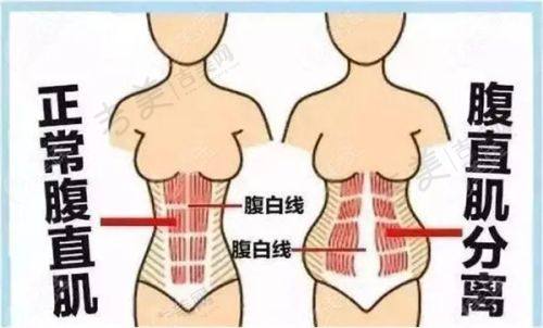 刘会省医生擅长的整形项目
