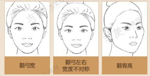 揭阳华美医疗整形美容医院怎么样,口碑评价如何?