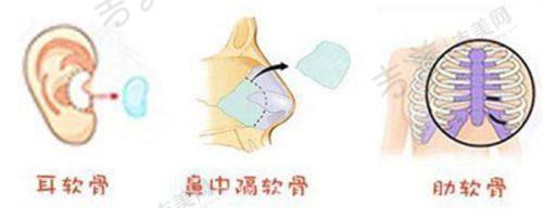 伍勇医生手术美容的技术优势