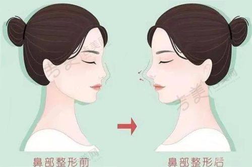 衢州华美医疗美容医院项目特色