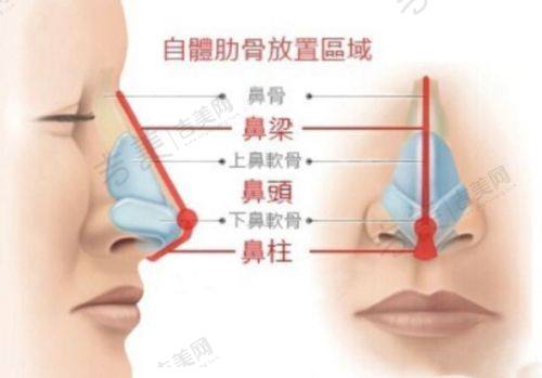 亳州华美整形美容医院项目特色