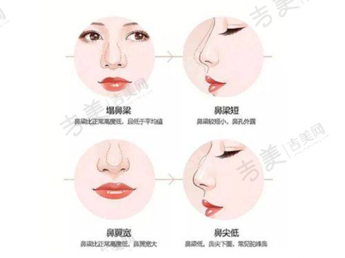 沧州华美医疗美容医院项目特色