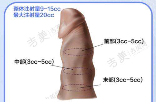徐霞医生的整形美容口碑评价及反馈内容
