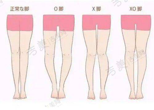 庞红霞医生的技术优势体现
