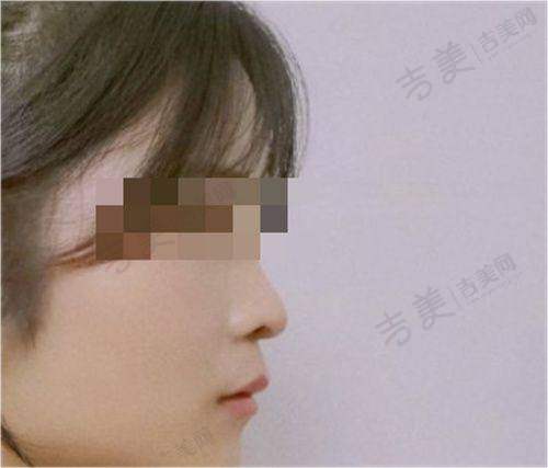 韩德医生擅长的项目介绍