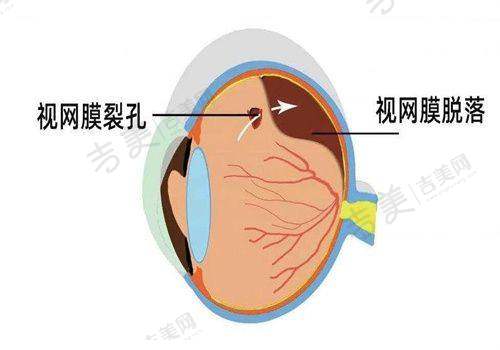 九江爱尔眼科医院电话是多少?