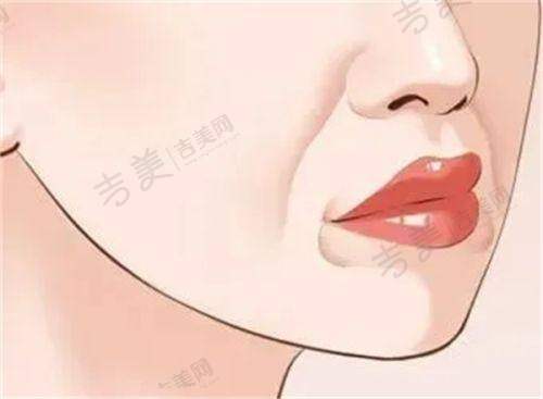 余洪斌医生擅长的医美项目