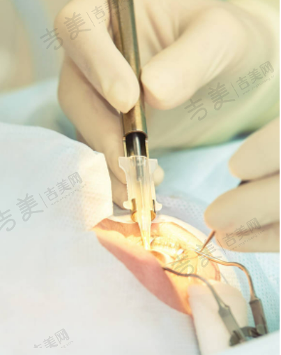 南宁爱尔眼科医院其他优势