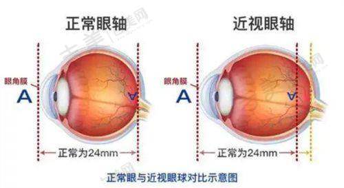 选择南宁爱尔眼科医院的理由