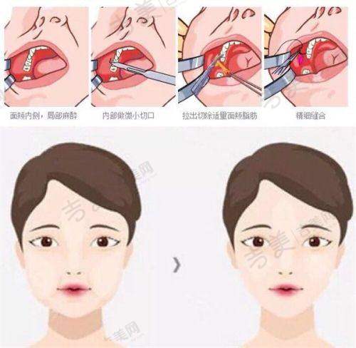 徐鹏医生的口碑评价及反馈内容