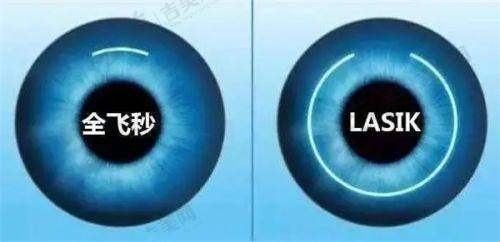 贵阳市角膜塑形镜(OK镜)好的医院排名情况——预约挂号攻略分享