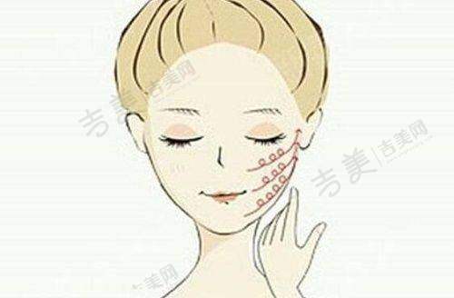 李德庆医生擅长的整形项目
