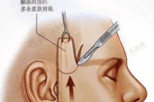 宜昌华美整形美容全身吸脂98000元起优势详解