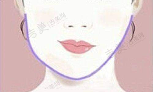 益阳杏林华美整形面部吸脂28000元起项目详情