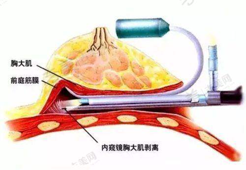 朴光哲医生擅长的整形项目