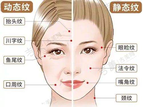 长沙华韩华美医疗整形美容蒜头鼻矫正25000元起顾客实例