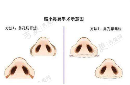廉乐天医生的技术优势亮点