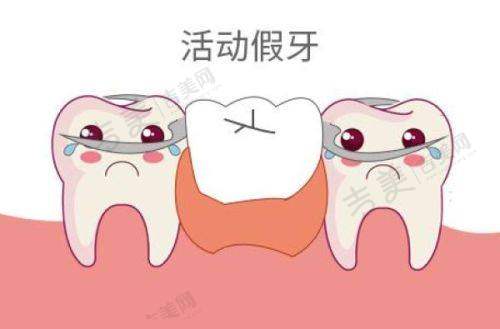 种牙必看：瑞士SIC种植体不同型号价格特点与价格关联