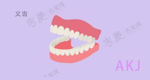 无牙颌种植覆盖义齿：功能与健康双保护的修复方式