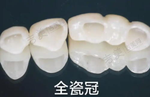 可丽尔隐形矫正价格包含的服务内容