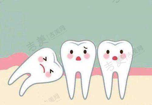 全瓷牙危害之引发龋病要当心