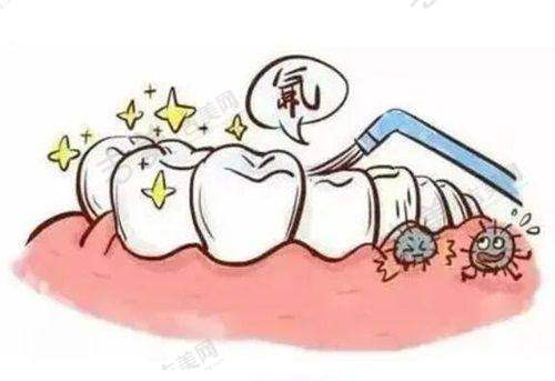 美国皓圣种植体真伪识别方法