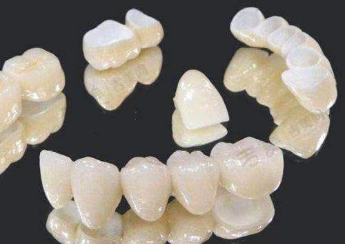 瑞典诺贝尔和瑞士ITI种植牙在不同医院的价格差异情况