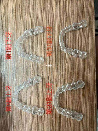 从价格上看，嵌体和牙冠哪个好？结合经济状况判断