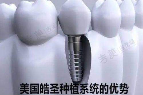 门牙是假牙可以戴隐形牙套吗？正畸矫治的具体情况