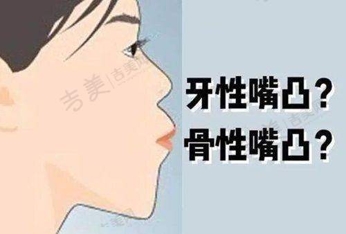 昆山六贝口腔门诊部瑞士SIC种植体价格优势与价格考量