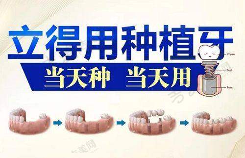 美国皓圣种植牙单颗低价情况分析