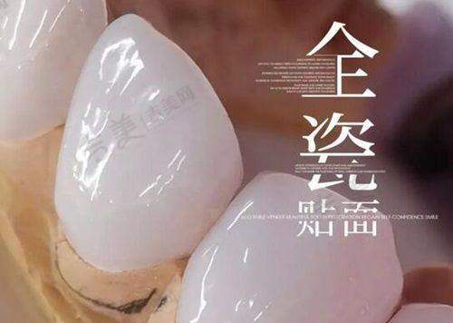 瑞士植体价格及特点