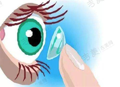 四、重庆何氏眼科和爱尔眼科对比情况之口碑评价对比