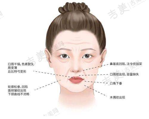 厦门薇格整形美容自体脂肪丰泪沟22000元起预约方式
