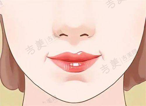 邓莎莎医生在整形领域的技术优势显著