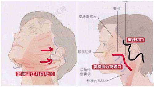 曾良生医生擅长的多样化整形项目