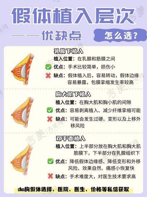 隆胸假体破裂取出换假体的费用及医院选择要点