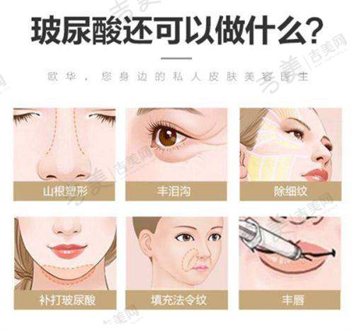 汪家莹医生的技术优势