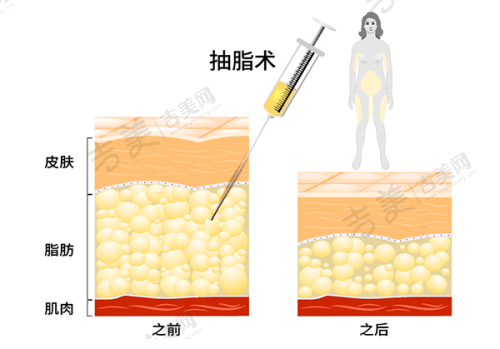 朴光哲医生的技术优势