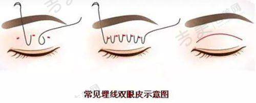 结尾