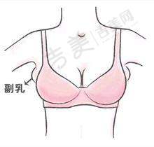 厦门薇格整形美容自体脂肪丰泪沟22000元起项目介绍