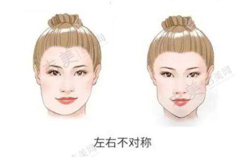 重庆星荣郑胜唇部塑形3980元起，伊婉VPLUS微笑唇定制顾客实例