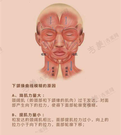 吉美网