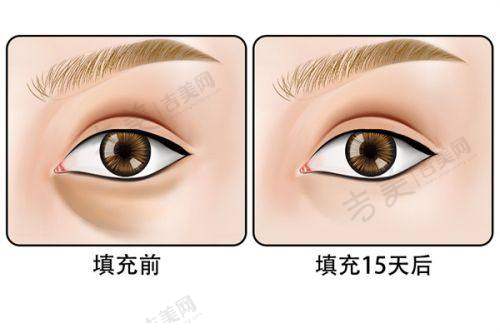吉美网