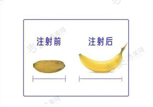 王杜医生的技术优势亮点