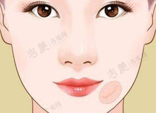 苏州吴中维多利亚美容医院江华医生的坐诊医院
