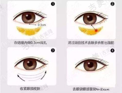吉美网